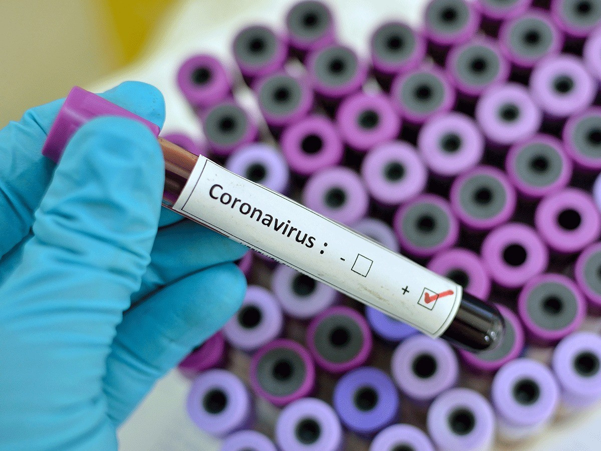 В 33 странах мира зафиксированы случаи заражения коронавирусом