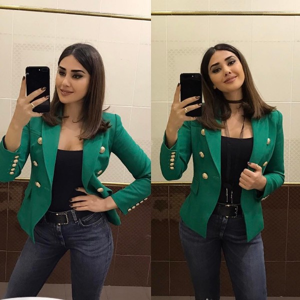 Aktrisa Pərvin Abıyeva üzündə dəyişiklik etdi